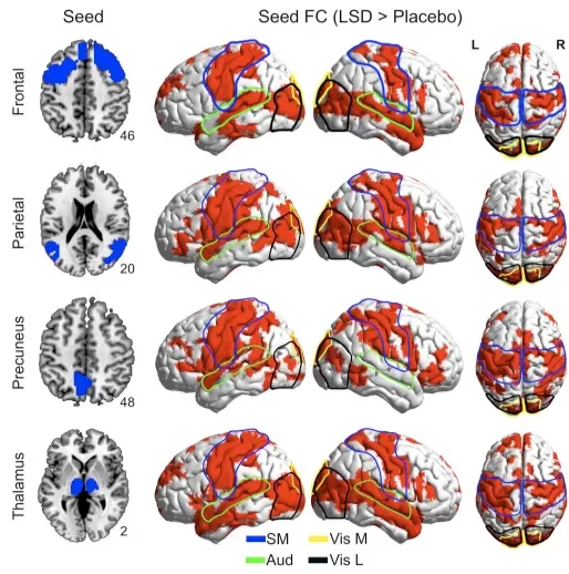 Increased Global Functional Connectivity Correlates with LSD Induced Ego Dissolution e1684937455456