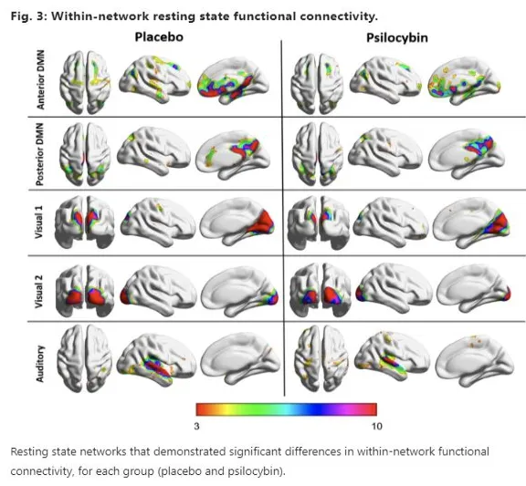 Within network resting state functional connectivity placebo and psilocybin